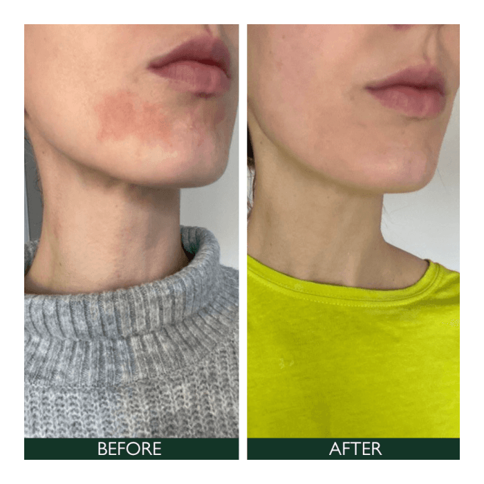 SORTED SKIN  Intensyvaus poveikio veido losjonas jautriai odai, 50 ml-2