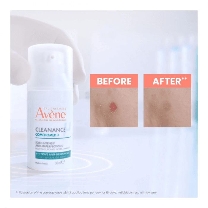 EAU THERMALE AVÈNE koncentratas į spuogus linkusiai odai CLEANANCE COMEDOMED +, 30 ml-2