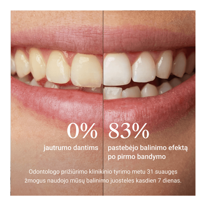 ALPINE WHITE, Dantų balinimo juostelės, 7 vnt.-2