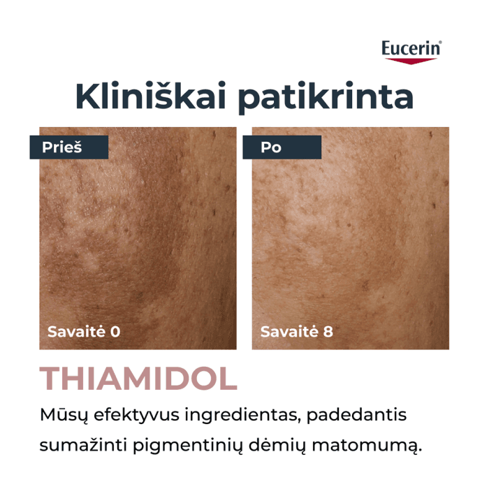 EUCERIN korektorius į pigmentaciją linkusiai odai ANTI-PIGMENT, 5 ml-1